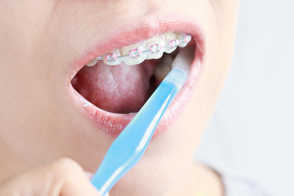 close up of brushing teeth | dental cleanings reservoir