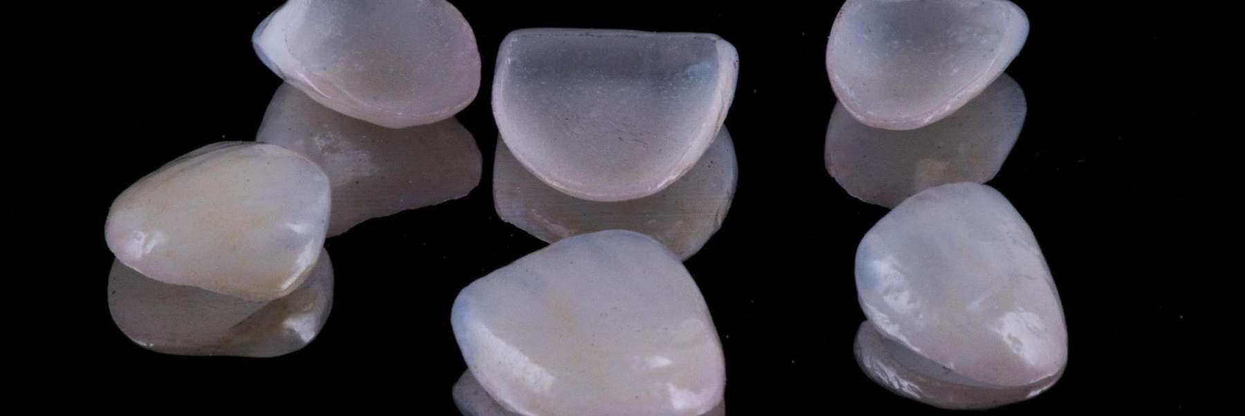 dental veneers | Reservoir Dentist