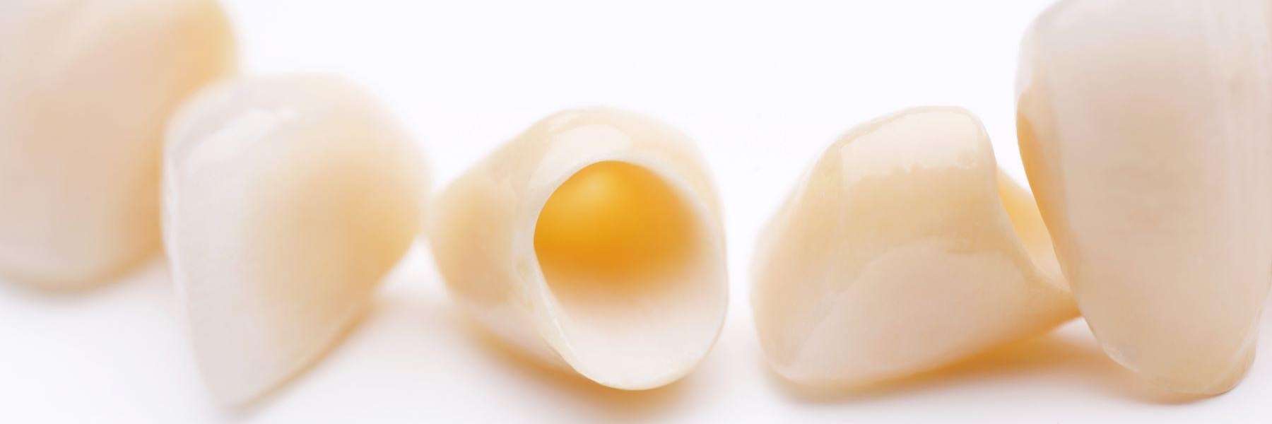 dental crowns in reservoir vic