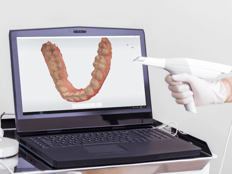 Dental Impressions in Reservoir, VIC
